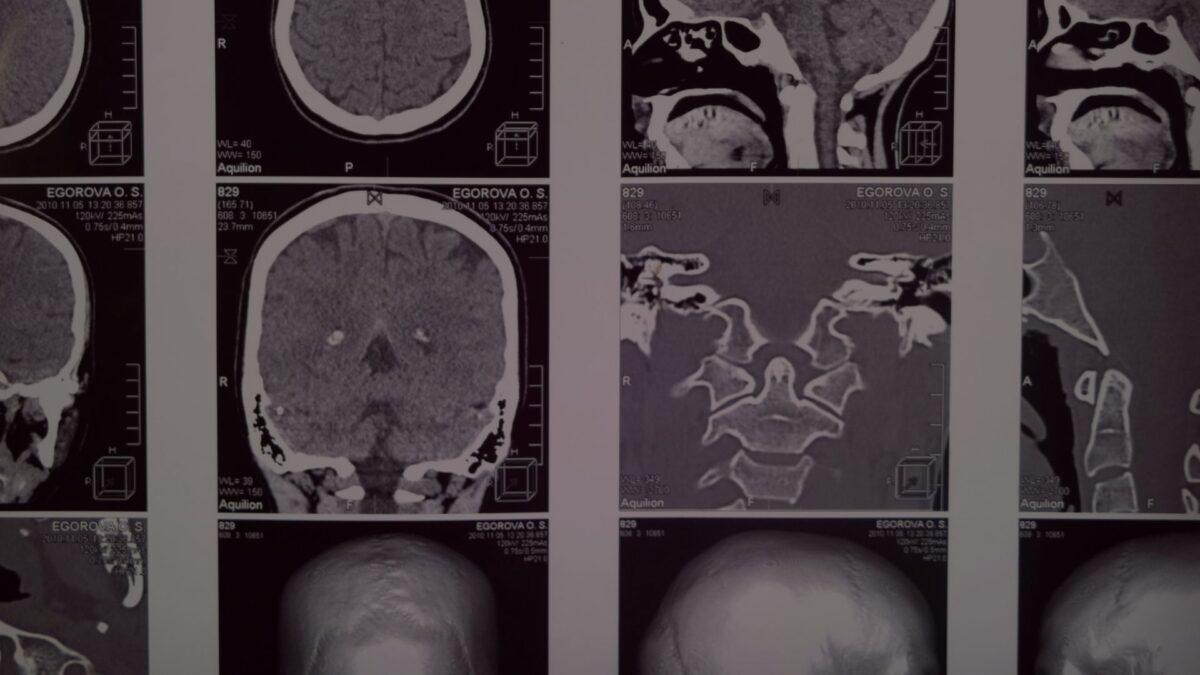 Neurobranding explains how the brain reacts when someone get in touch with a brand.